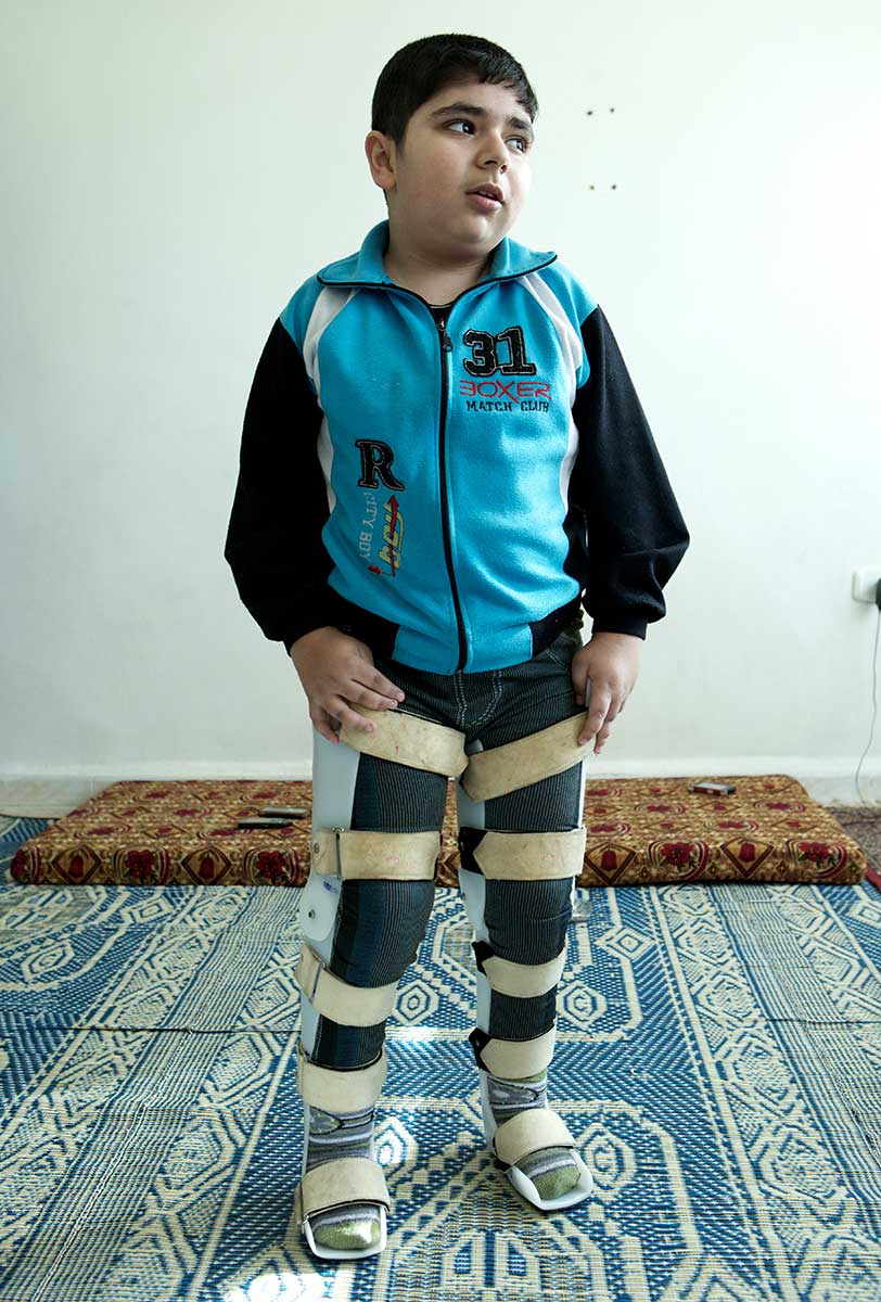 Bashar was hit by shrapnel from a bomb blast while fleeing the fighting in Syria with his family. His left leg was shattered. Already suffering from childhood arthrithis, he didn't get medical care soon enough and his legs got weaker from lack of use. Our team in Jordan found him in desperate need of rehabilitation and took action to stop his condition deteriorating further. His recovery was painful and slow, but his family helped him do his exercises every day. Finally he could stand again with brace supports - his first step to walking again unaided. © Giles Duley/Handicap International