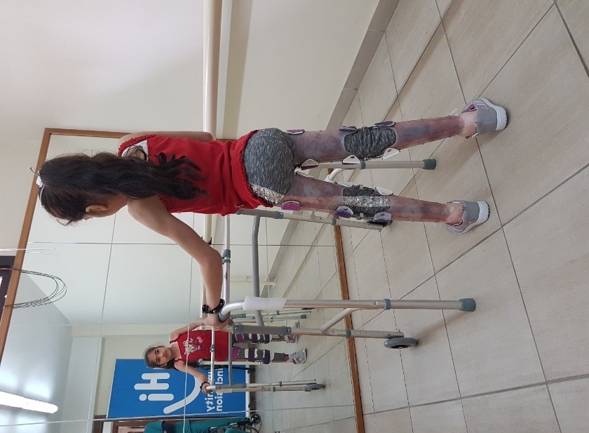Shahid learns to walk with her assistive devices to become independent and confident