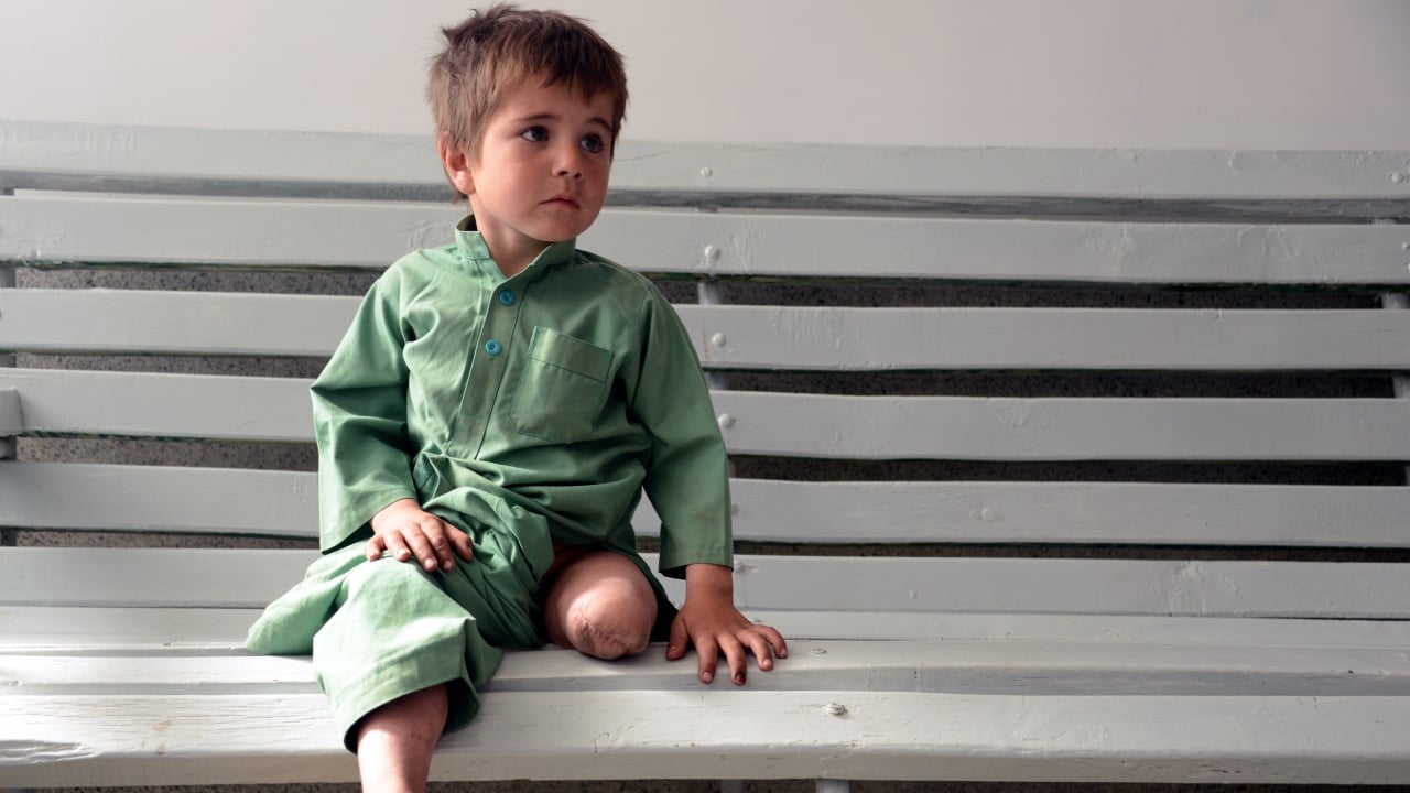 Sayed Rasool is a 6 year old boy from Afghanistan who was injured when an improvised mine exploded.