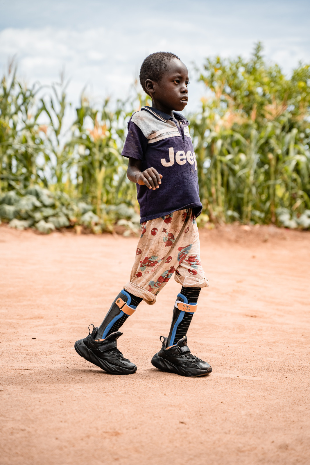 A young Black boy walks on his own. He's wearing braces on his legs. 