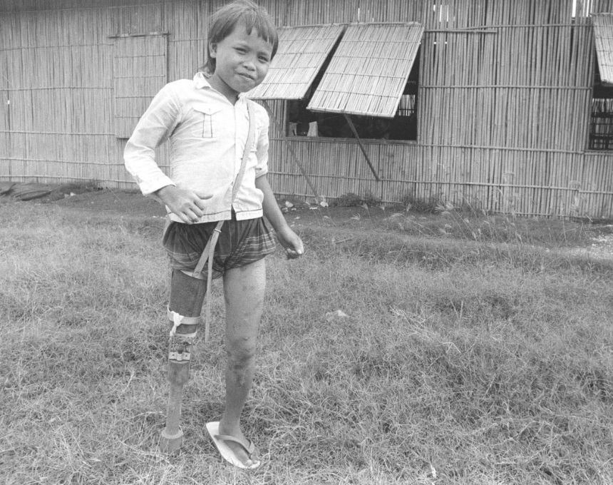 A young Cambodian girl stands wearing an artificial limb made of bamboo