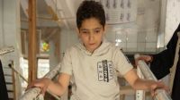 Yasser, 12, during a rehabilitation session at the Sana'a center
