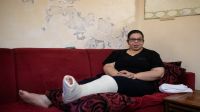 Nada Baghdadi, 27, suffered a broken leg when two explosions ripped through the port of Beirut on 4 August. 