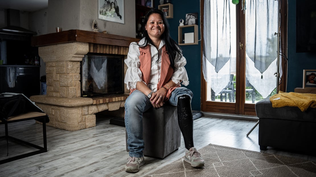 Woman smiling as she sits on an ottoman sitting inside a house, with a fireplace and glass door behind her. She's wearing a white frilly button down, a pink pinstripe fest, blue jeans and white sneakers. Her left leg is a prosthetic. 