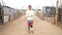 Atilio, a young man, standing with his prosthesis and arms crossed, outside his home in the informal settlement on a dirt road,