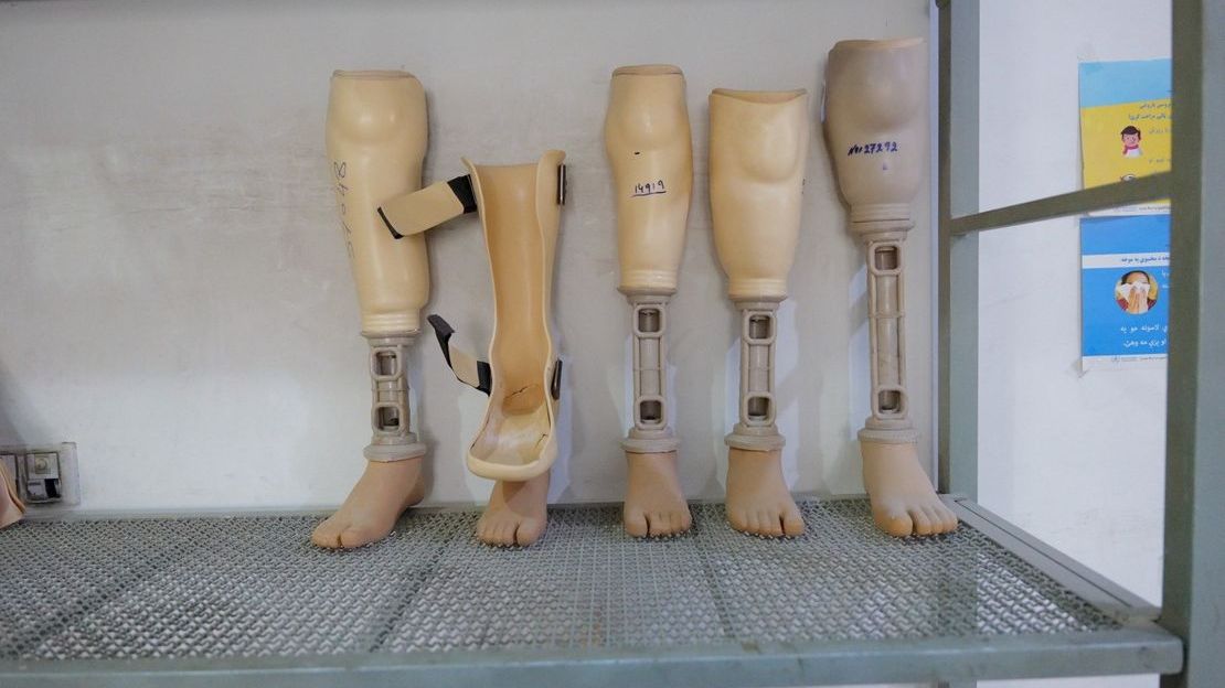 Prosthesis made at HI’s rehabilitation center in Kandahar. 