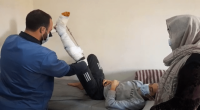 A teenager is lying on his hospital bed, his leg is broken and the physiotherapist makes him do rehabilitation exercises with his mother to support him.