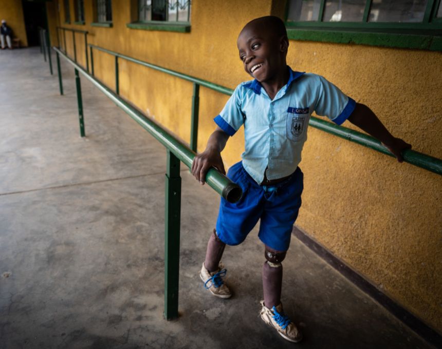 A small Black boy wearing a blue school uniform and artificial legs smiles while walking between green parallel bars