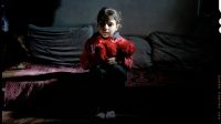 Sondos, 8, ws injured in a bombing on her school in Syria.