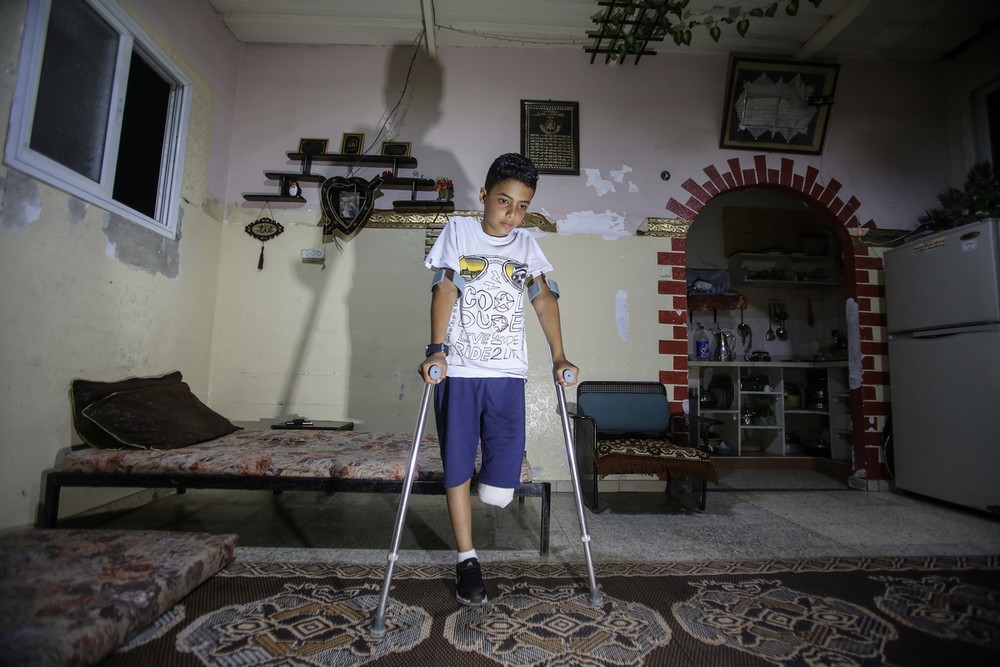 A 11-year-old boy who lost his leg during the demonstrations in Gaza on 12th May 2018. © Ali Jadallah / Anadolu Agency / AFP