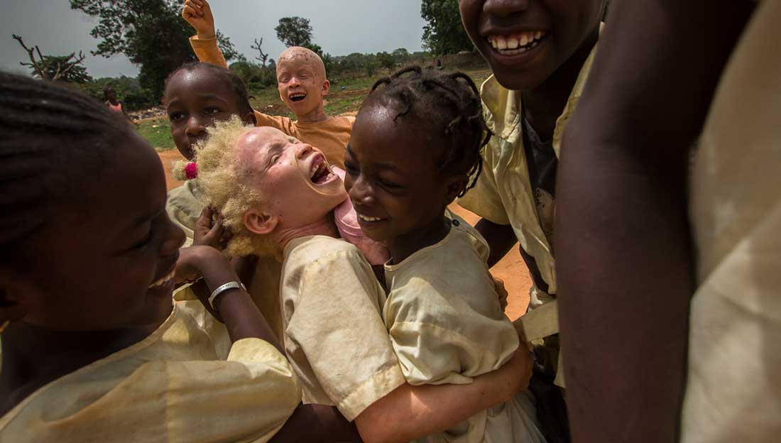 Aicha, 10, playing with her friends in the playground of her school. Aicha is a beneficiary of the Integrated Project on Inclusive Education, Protection and Early Detection of Disabilities that HI has been implementing in Guinea-Bissau. Aicha loves playing and having fun with her school friends. An extroverted character, she is very integrated within her group of classmates and has lots of friends.