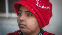 Nada, 10, was seriously injured in a bombing in Mosul.