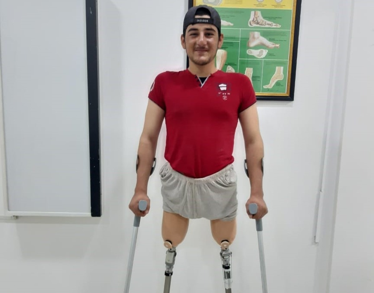 Ismail is pleased with his new prostheses 