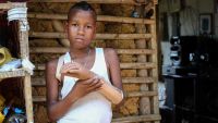 Jemerson, 12, lost his left hand to a landmine left over from the conflict in Colombia. 
