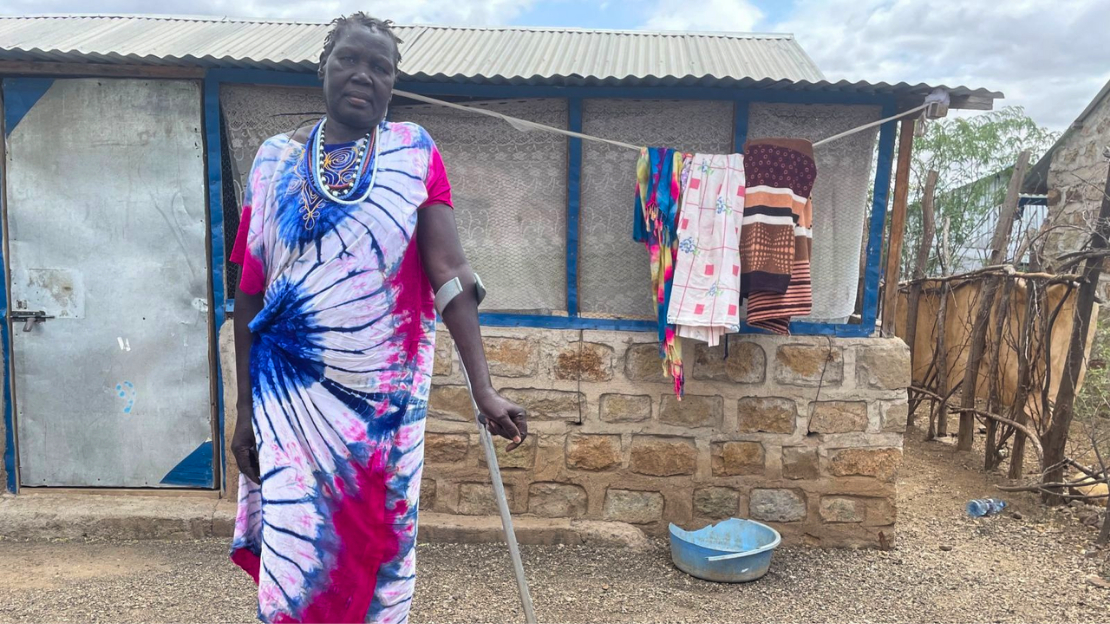 A woman wearing a blue and pink tie-dyed dress stands with an elbow crutch in front of a house with a clothing line