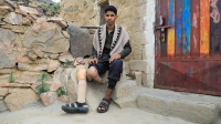 A teenage Yemeni boy sits on a ledge with an artificial leg resting beside him.