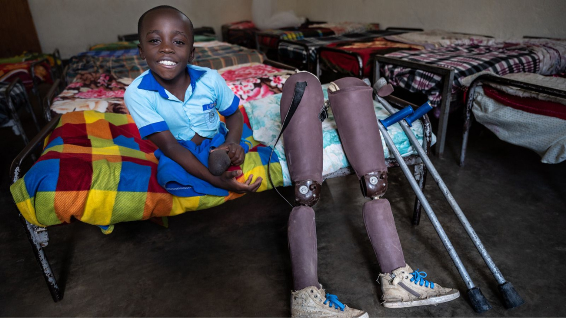 A smiling young boy who does not have legs sits on a bed in a room full of beds. His crutches and artificial legs are beside him.