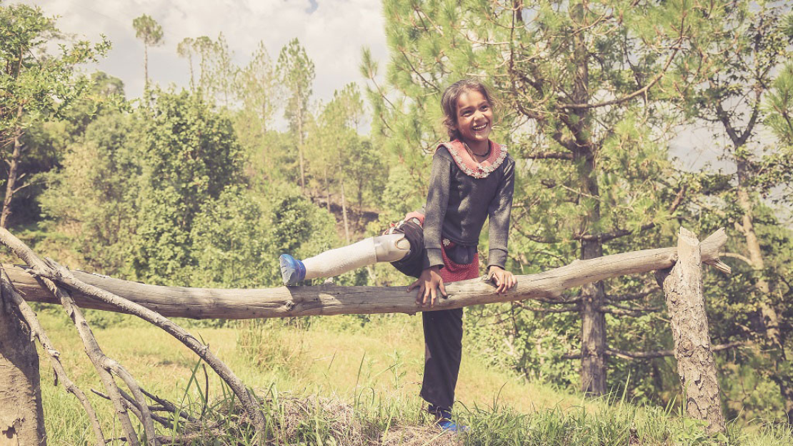 A young girl smiles as she lifts her prosthetic leg over a tree branch.