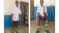 Abderamane standing outside HI’s rehabilitation room at Bambari hospital.