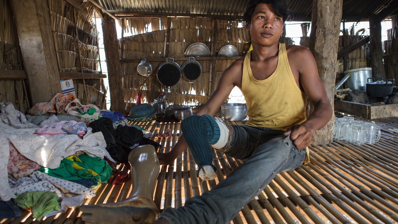 Nak, 17, landmine survivor and future motorbike mechanic. Cambodia.