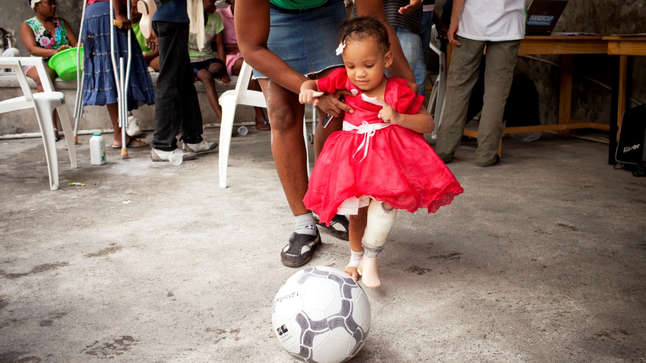 Blaurah, 17 months, tries playing football with her first prosthesis with the help of her mother, at an orthopedic center in Haiti.