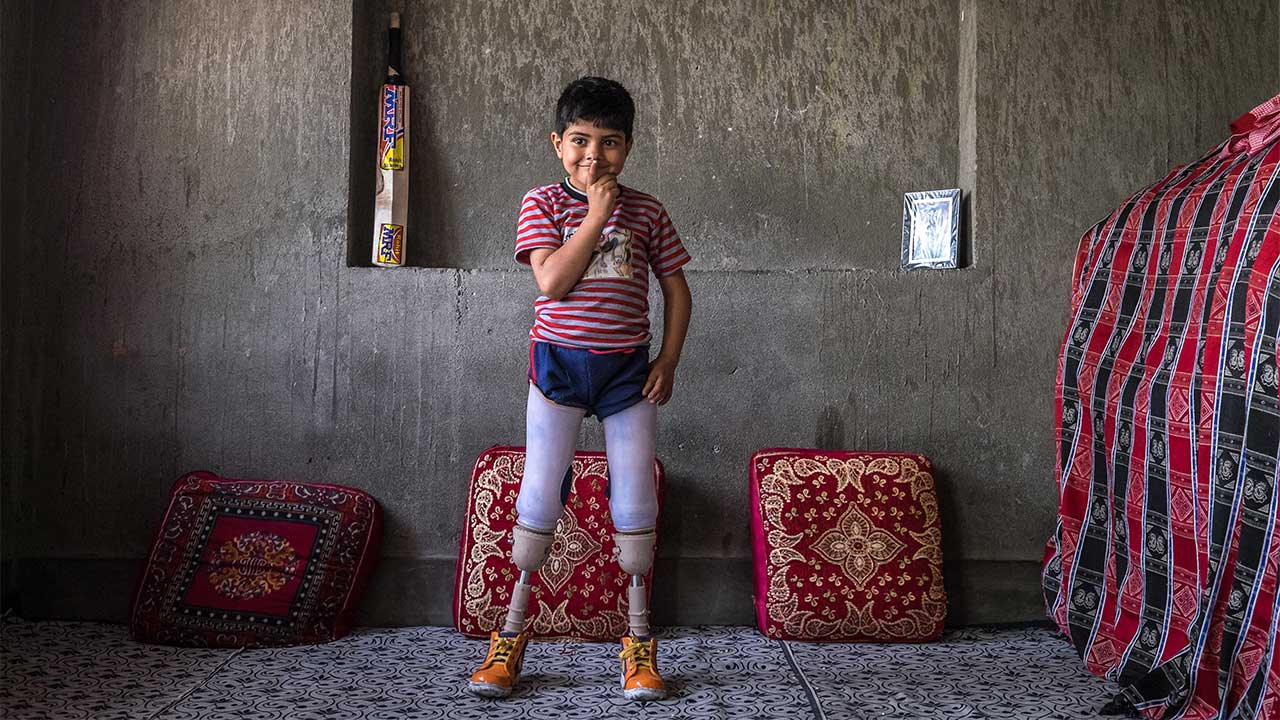 Fayaz, 5, standing up using his artificial legs, Kashmir