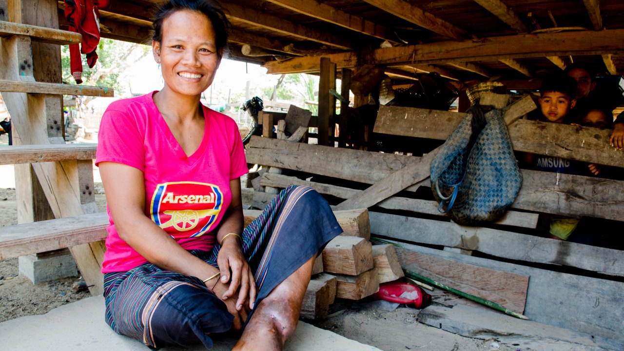 Nang sits outside her home, with her leg injury visible. 