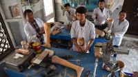 A artificial limbs and braces workshop at the National Disabled Fund rehabilitation center in Kathmandu, which is supported by Handicap International. Nepal.
