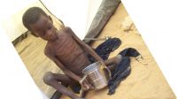 A malnourished child refugee found during an evaluation mission in the Abala camp north of Niamey, Niger.