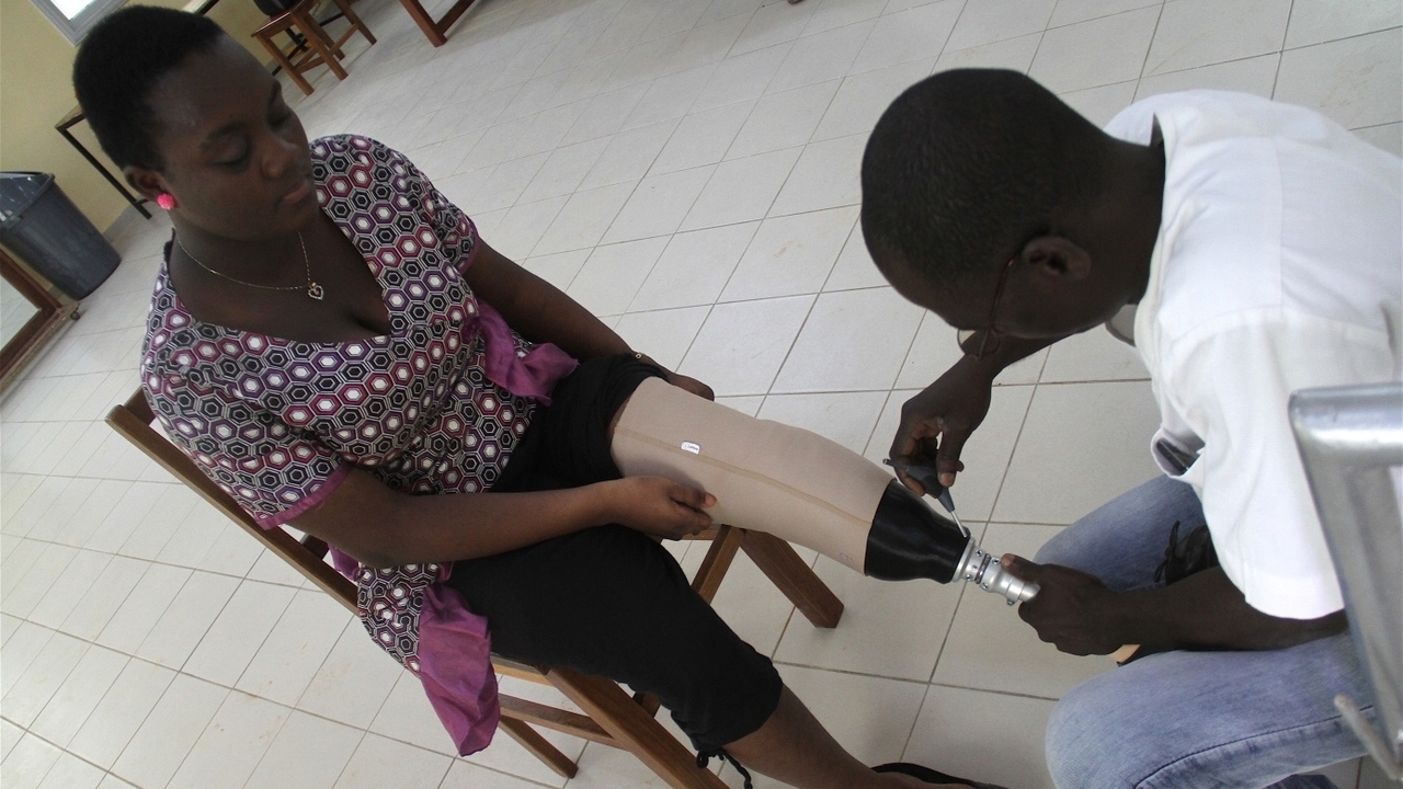 A trial participant receives her bespoke 3D printed socket